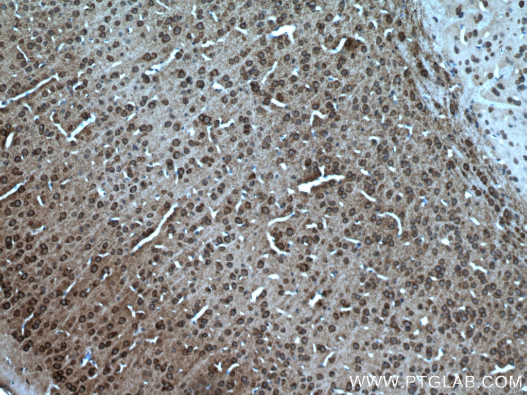 Immunohistochemistry (IHC) staining of mouse brain tissue using SLC4A10 Polyclonal antibody (27197-1-AP)