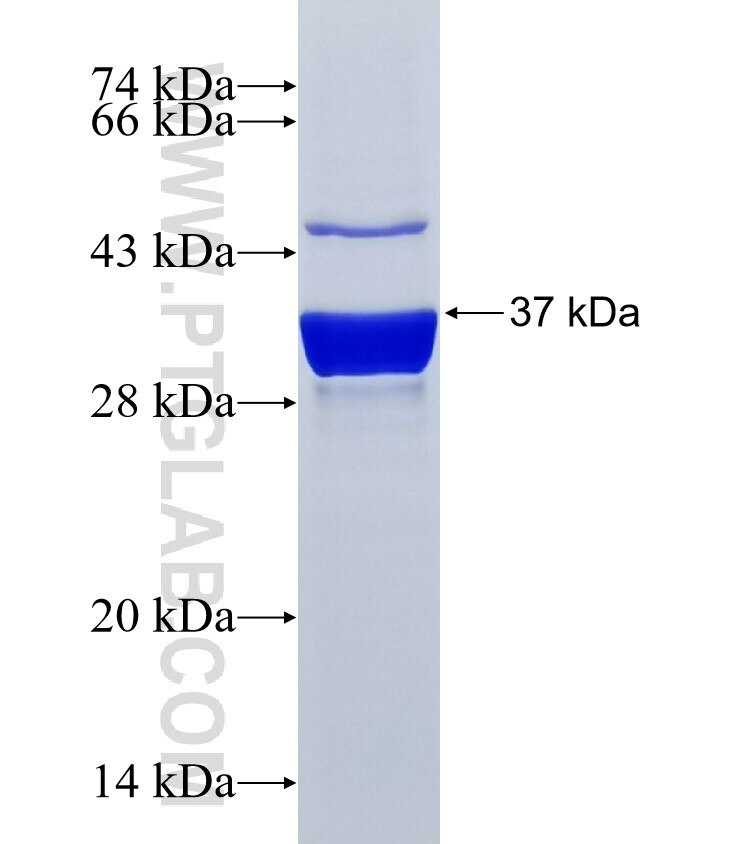 SLC4A10 fusion protein Ag26102 SDS-PAGE