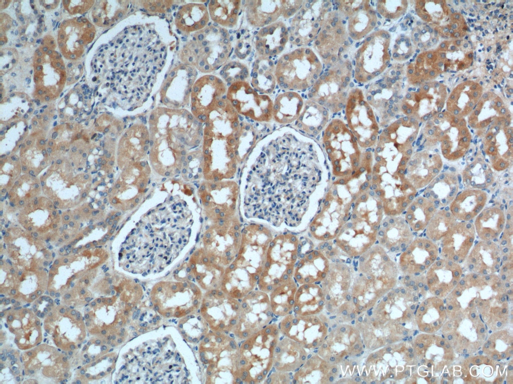 Immunohistochemistry (IHC) staining of human kidney tissue using SLC4A1AP Polyclonal antibody (21517-1-AP)