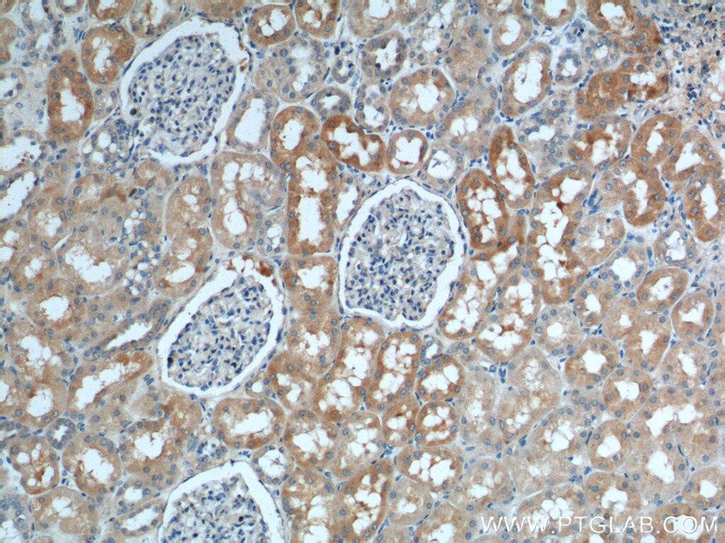 IHC staining of human kidney using 21517-1-AP