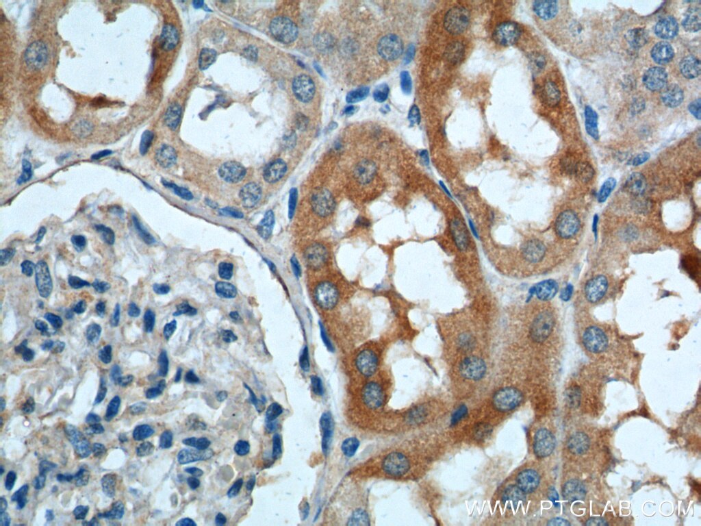 Immunohistochemistry (IHC) staining of human kidney tissue using SLC4A1AP Polyclonal antibody (21517-1-AP)