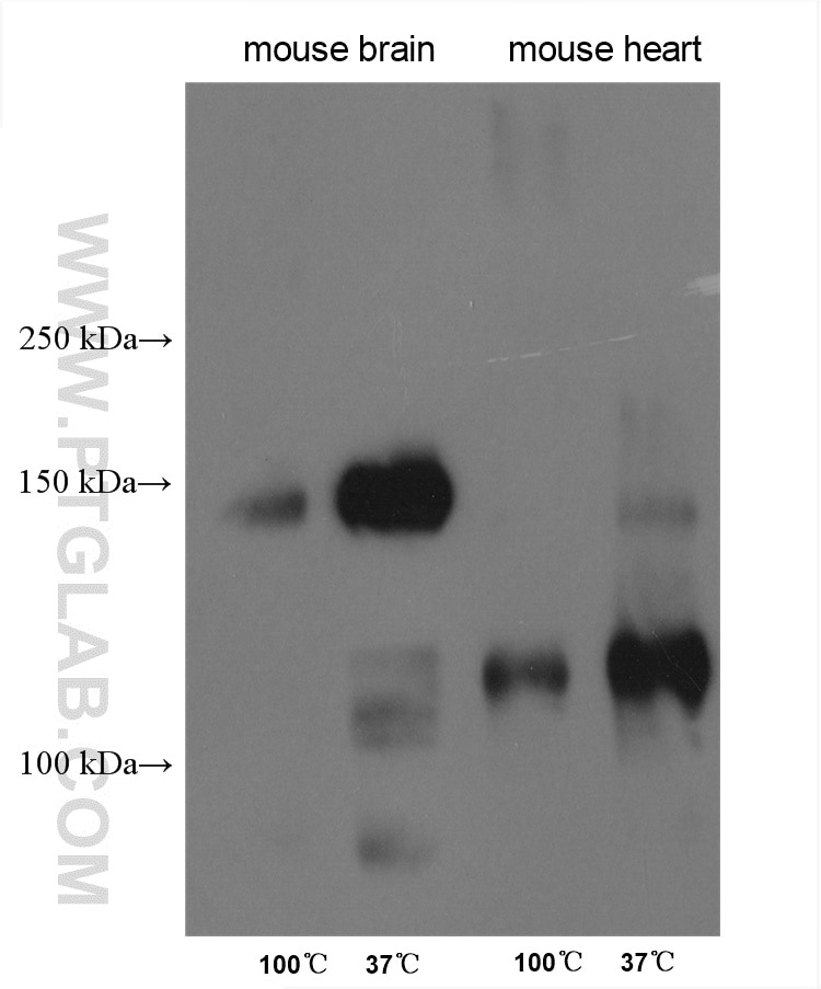 Western Blot (WB) analysis of various lysates using SLC4A3 Polyclonal antibody (26883-1-AP)