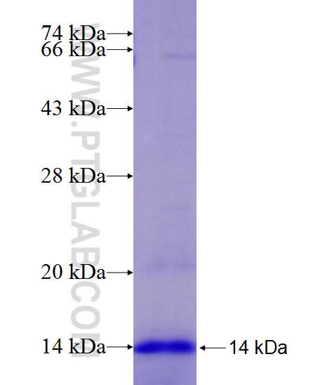 SLC4A3 fusion protein Ag25457 SDS-PAGE