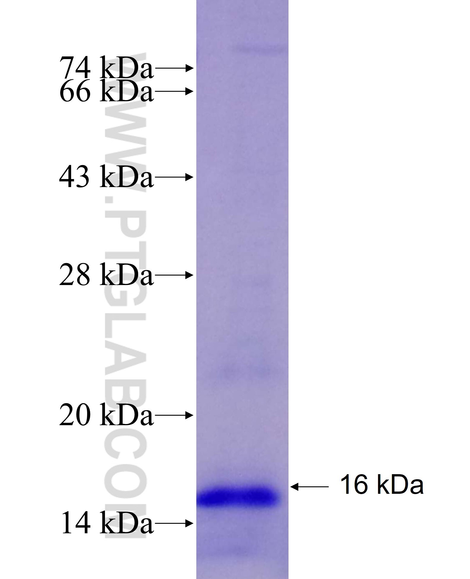 SLC4A3 fusion protein Ag25457 SDS-PAGE