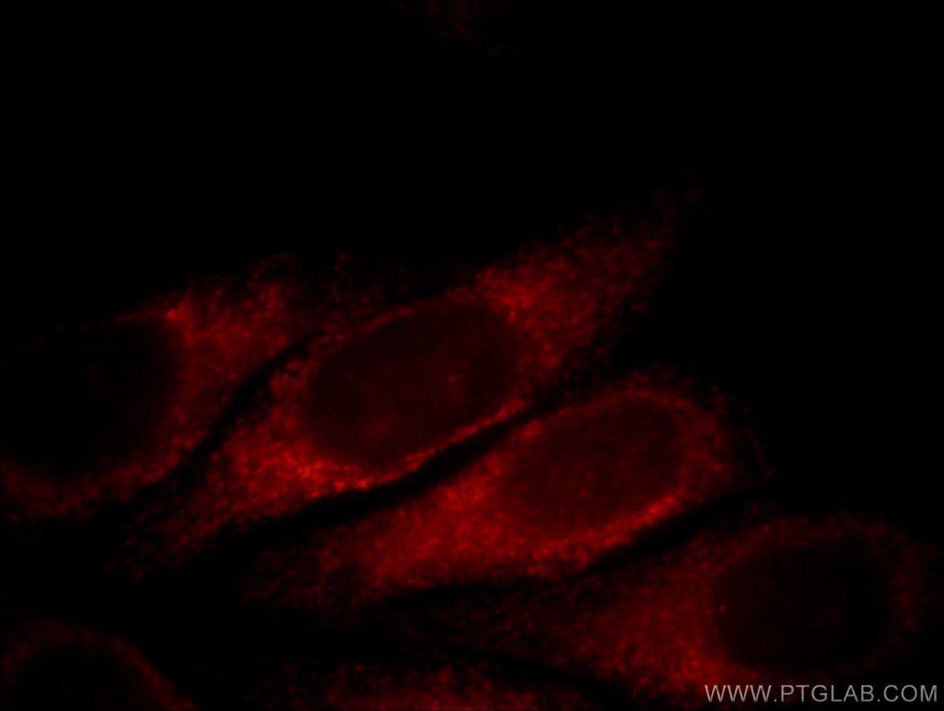 Immunofluorescence (IF) / fluorescent staining of HepG2 cells using SLC4A4 Polyclonal antibody (11885-1-AP)