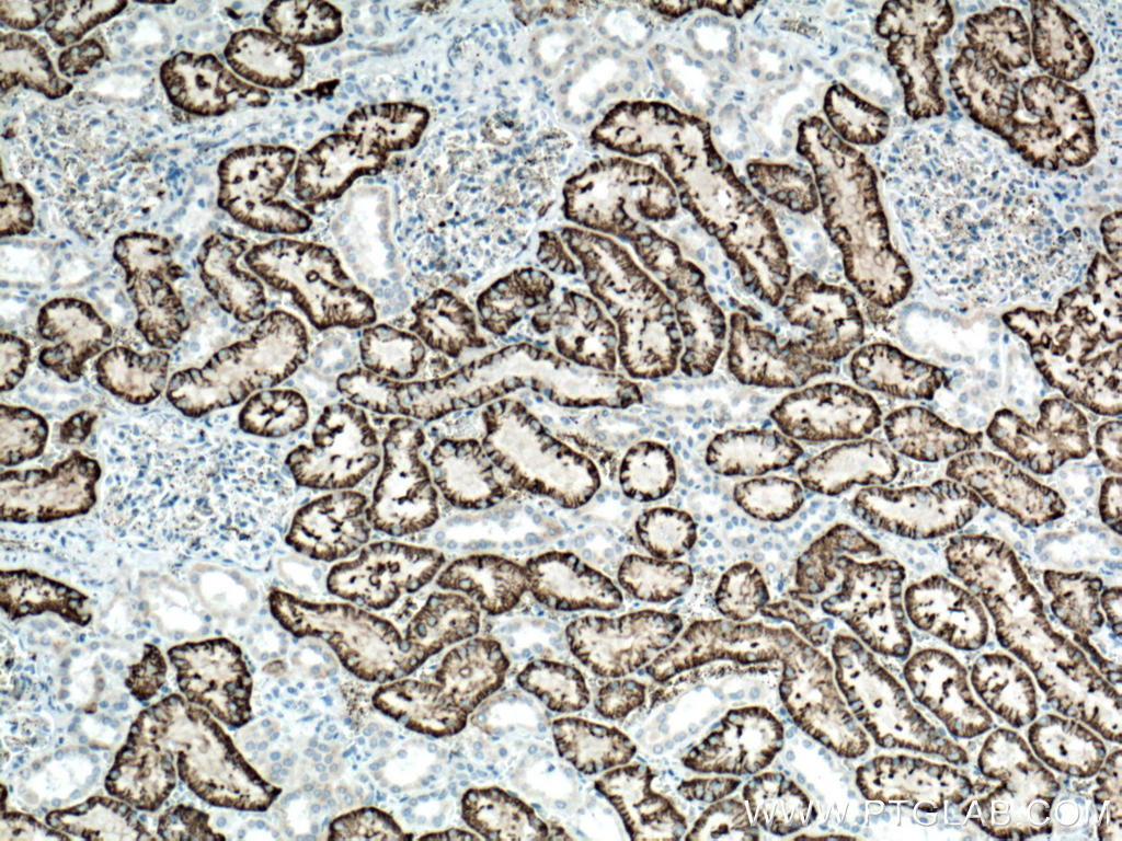 Immunohistochemistry (IHC) staining of human kidney tissue using SLC4A4 Polyclonal antibody (11885-1-AP)
