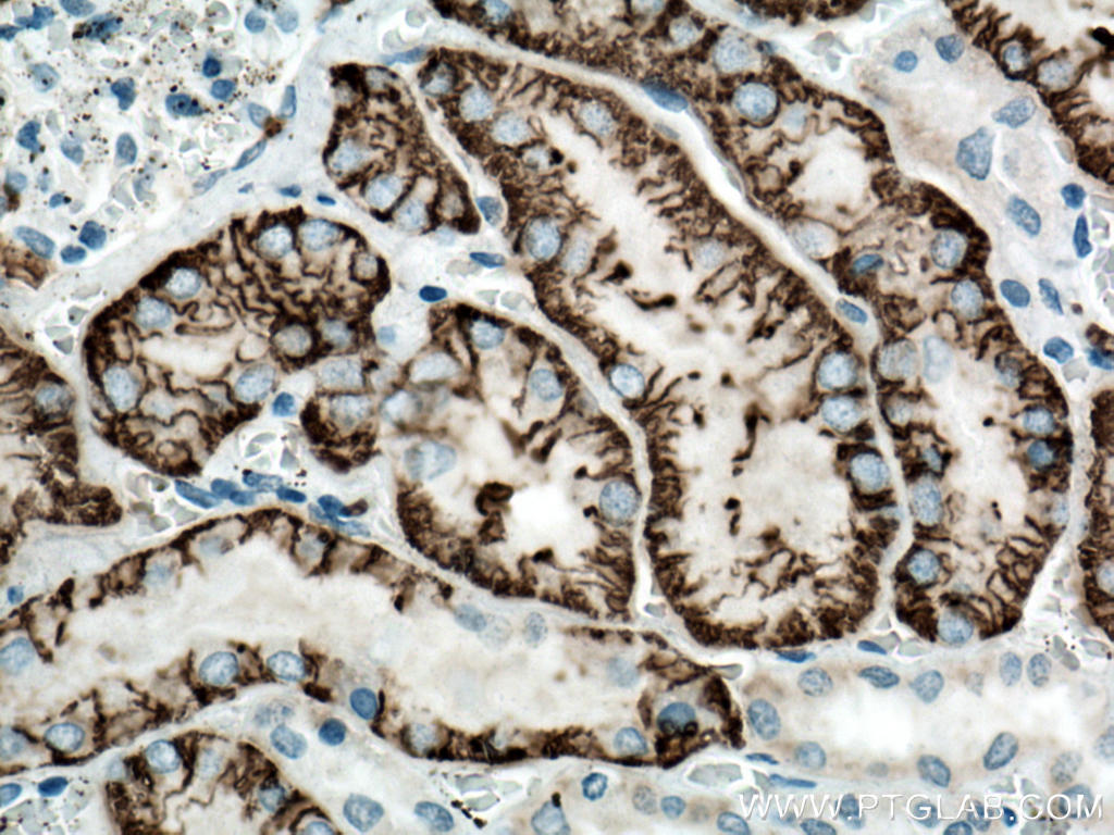 Immunohistochemistry (IHC) staining of human kidney tissue using SLC4A4 Polyclonal antibody (11885-1-AP)