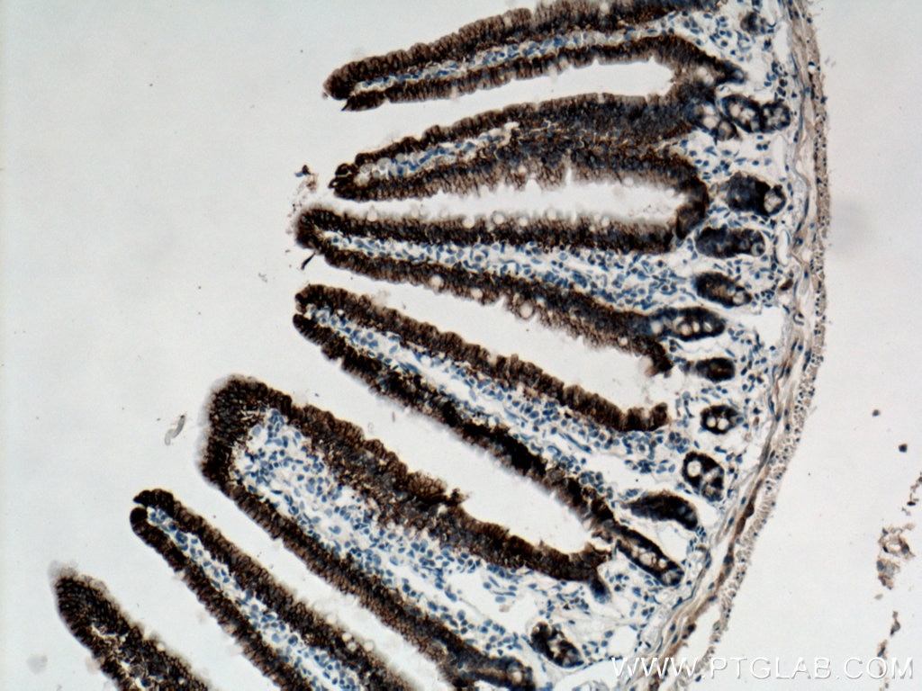 Immunohistochemistry (IHC) staining of mouse small intestine tissue using SLC4A4 Polyclonal antibody (11885-1-AP)