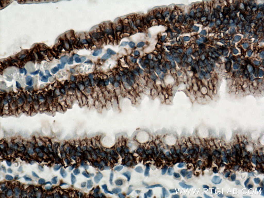Immunohistochemistry (IHC) staining of mouse small intestine tissue using SLC4A4 Polyclonal antibody (11885-1-AP)
