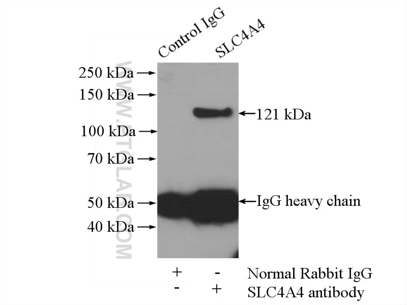 Immunoprecipitation (IP) experiment of HEK-293 cells using SLC4A4 Polyclonal antibody (11885-1-AP)