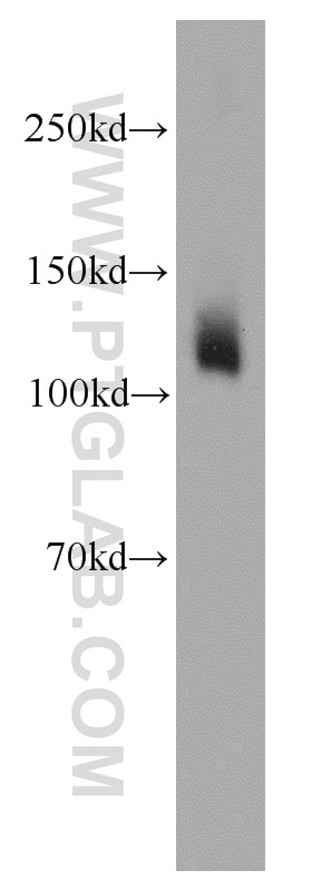Western Blot (WB) analysis of mouse kidney tissue using SLC4A4 Polyclonal antibody (11885-1-AP)