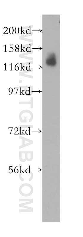 Western Blot (WB) analysis of HEK-293 cells using SLC4A4 Polyclonal antibody (11885-1-AP)