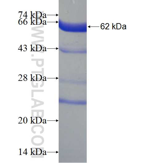 SLC4A4 fusion protein Ag2490 SDS-PAGE