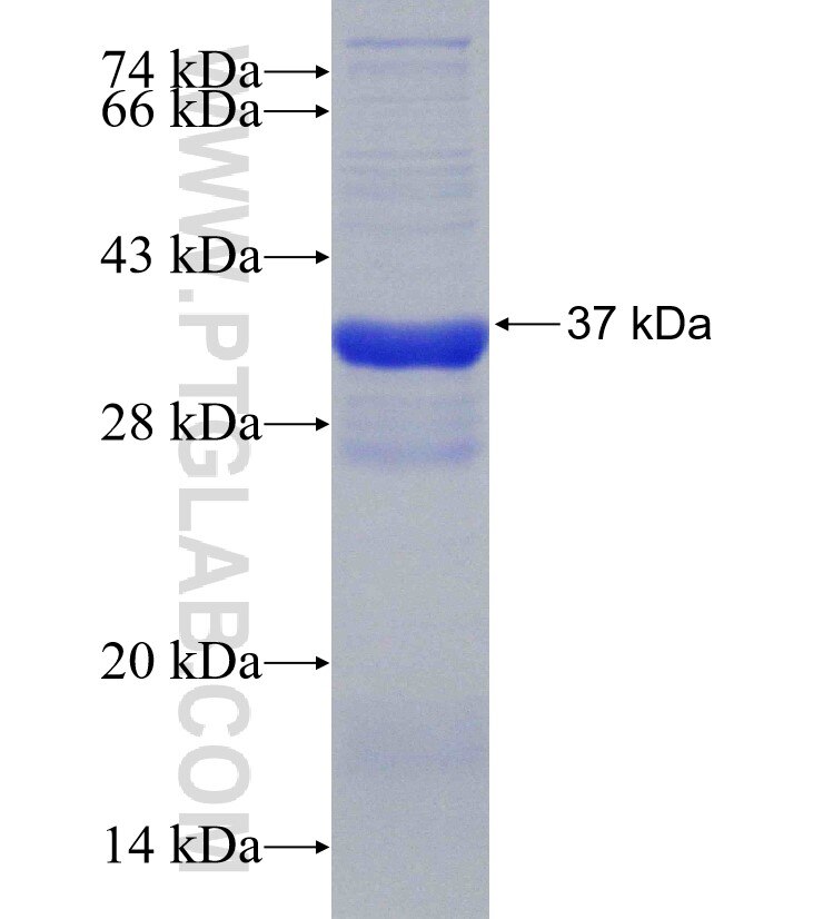 SLC4A7 fusion protein Ag30545 SDS-PAGE