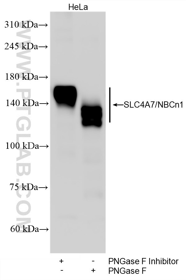WB analysis of HeLa using 83676-5-RR (same clone as 83676-5-PBS) Western Blot (WB) analysis of HeLa cells using SLC4A7/NBCn1 Recombinant monoclonal antibody (83676-5-RR)