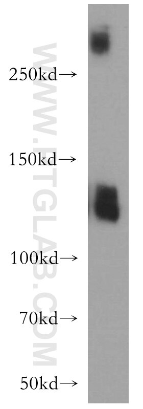 Western Blot (WB) analysis of mouse brain tissue using SLC4A8 Polyclonal antibody (12531-1-AP)