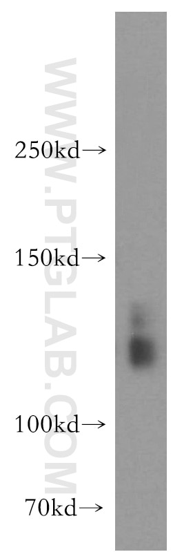 Western Blot (WB) analysis of human brain tissue using SLC4A8 Polyclonal antibody (12531-1-AP)