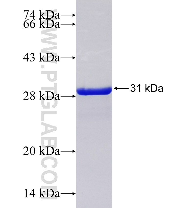 SLC51A fusion protein Ag34517 SDS-PAGE