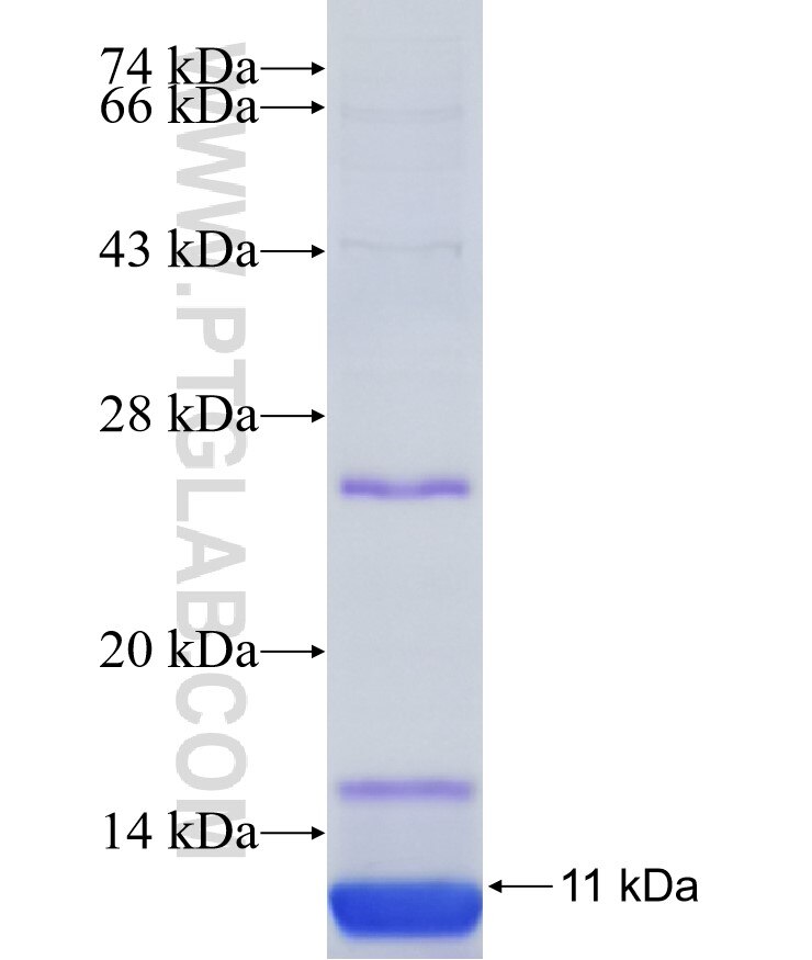 SLC51A fusion protein Ag34796 SDS-PAGE