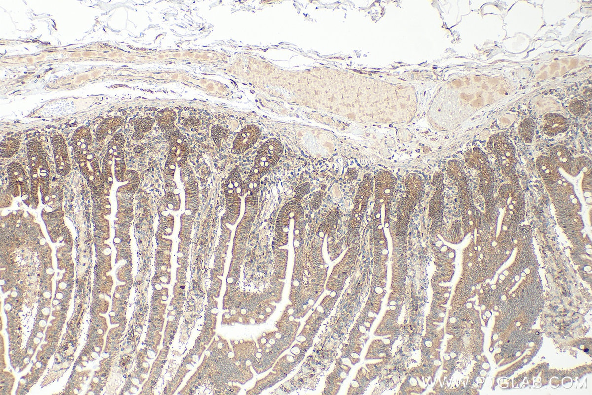 IHC staining of human small intestine using 30396-1-AP Immunohistochemistry (IHC) staining of human small intestine tissue using SLC52A2 Polyclonal antibody (30396-1-AP)