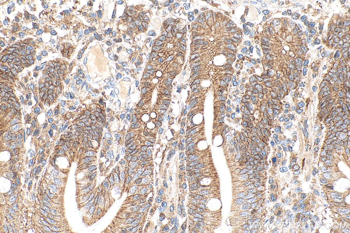 IHC staining of human small intestine using 30396-1-AP Immunohistochemistry (IHC) staining of human small intestine tissue using SLC52A2 Polyclonal antibody (30396-1-AP)