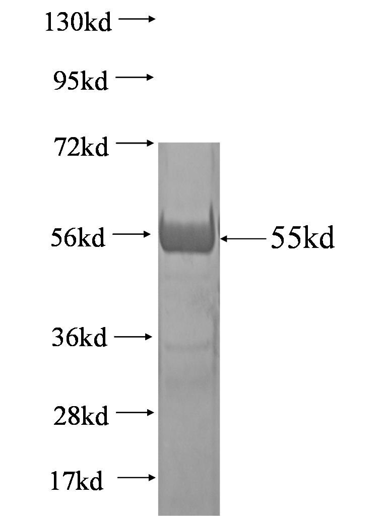 SLC5A1 fusion protein Ag0723 SDS-PAGE