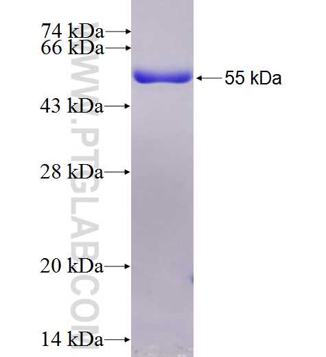 SLC5A1 fusion protein Ag1546 SDS-PAGE