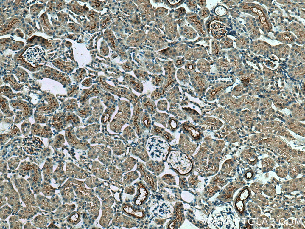 Immunohistochemistry (IHC) staining of mouse kidney tissue using SLC5A10 Polyclonal antibody (17341-1-AP)