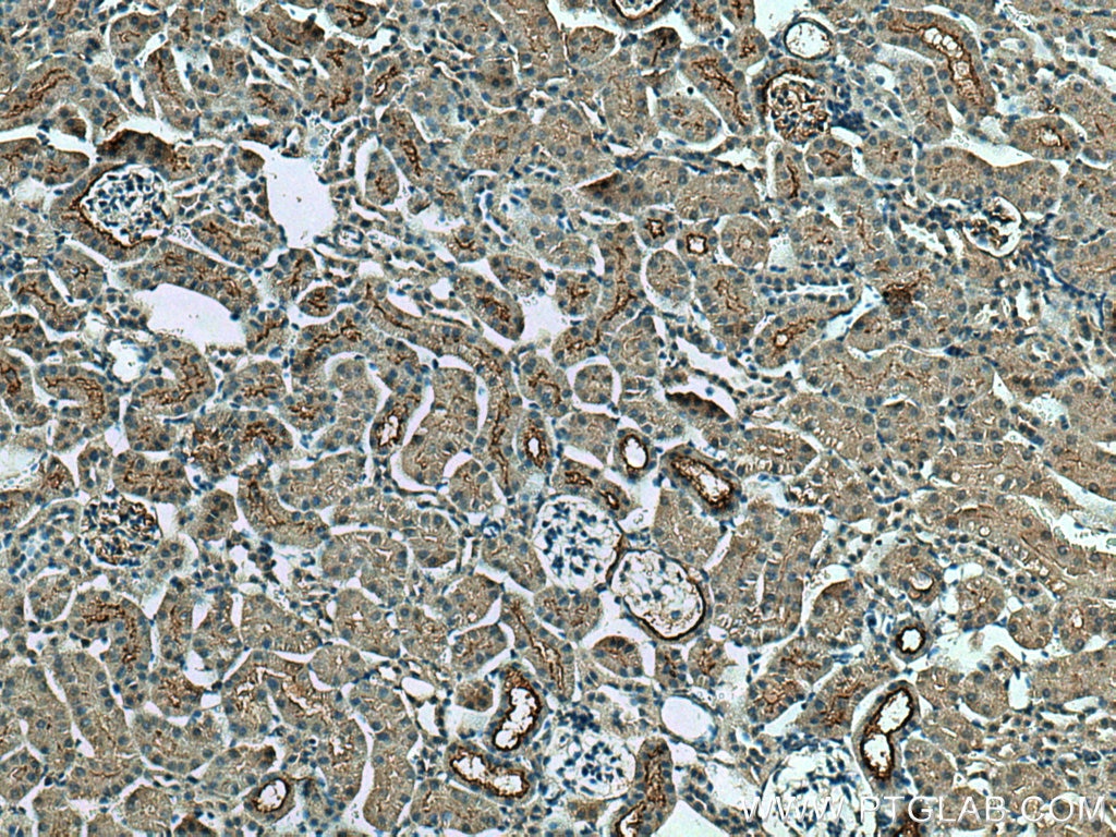 IHC staining of mouse kidney using 17341-1-AP