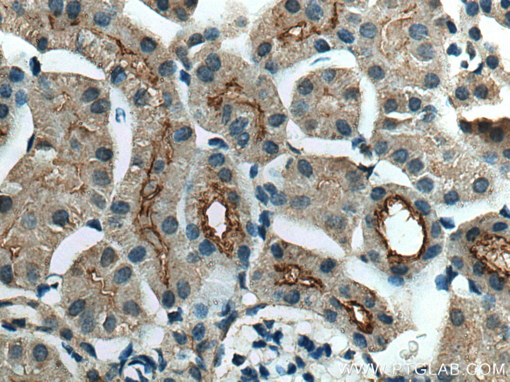 Immunohistochemistry (IHC) staining of mouse kidney tissue using SLC5A10 Polyclonal antibody (17341-1-AP)