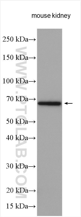 Western Blot (WB) analysis of various lysates using SLC5A10 Polyclonal antibody (17341-1-AP)
