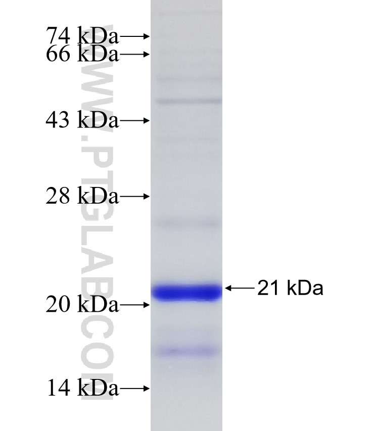 SLC5A10 fusion protein Ag11352 SDS-PAGE