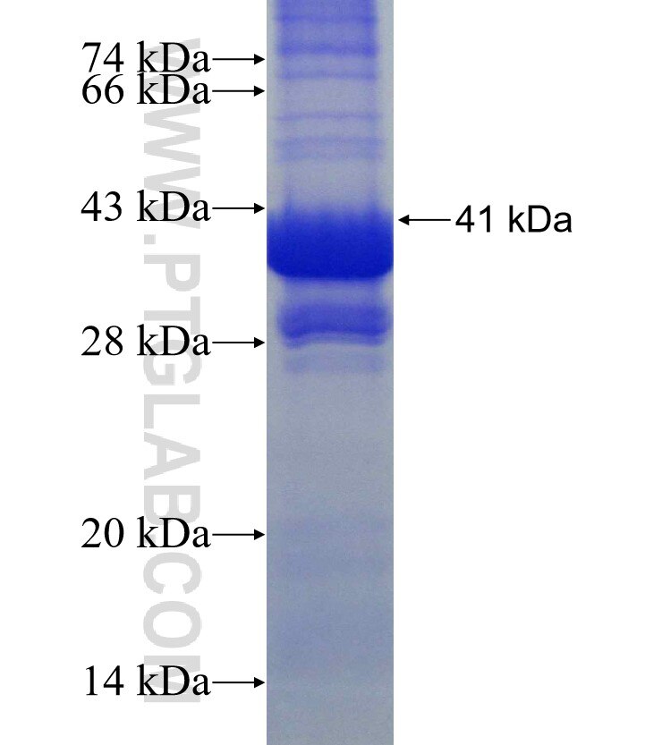 SLC5A10 fusion protein Ag11378 SDS-PAGE