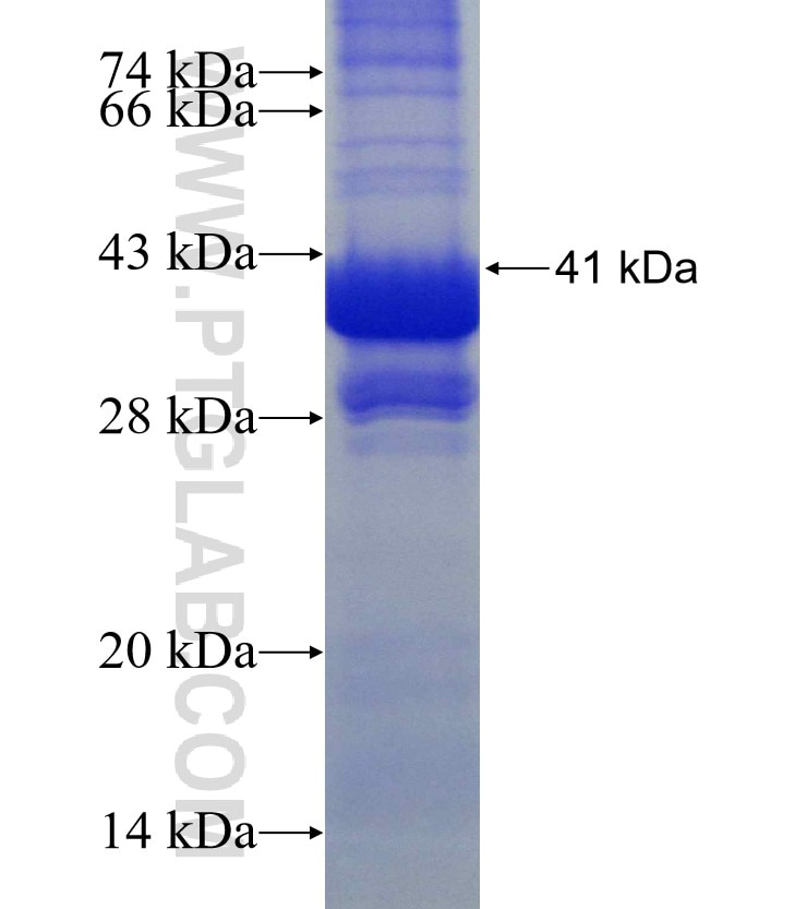 SLC5A10 fusion protein Ag11378 SDS-PAGE