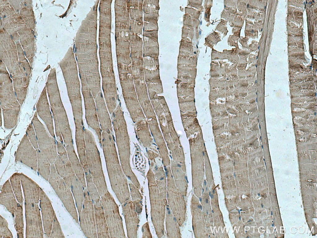 Immunohistochemistry (IHC) staining of mouse skeletal muscle tissue using SLC5A11 Polyclonal antibody (14089-1-AP)