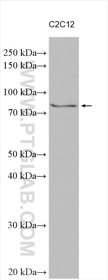 Western Blot (WB) analysis of various lysates using SLC5A11 Polyclonal antibody (14089-1-AP)