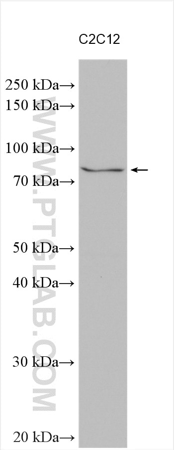 Western Blot (WB) analysis of various lysates using SLC5A11 Polyclonal antibody (14089-1-AP)