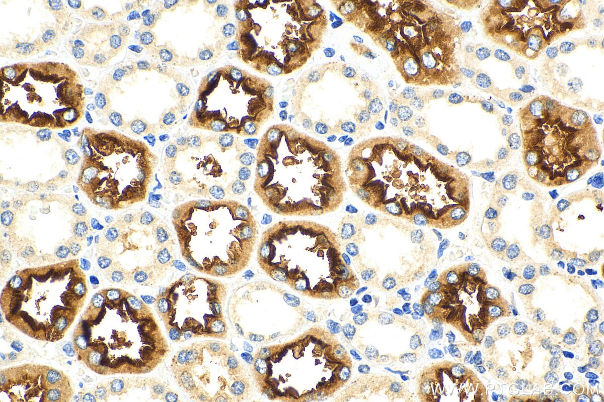 Immunohistochemistry (IHC) staining of human kidney tissue using SLC5A11 Polyclonal antibody (28648-1-AP)