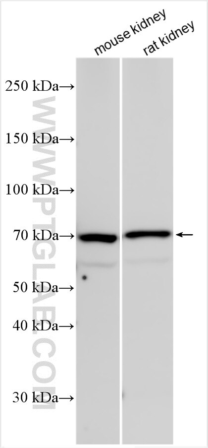 Western Blot (WB) analysis of various lysates using SLC5A11 Polyclonal antibody (28648-1-AP)