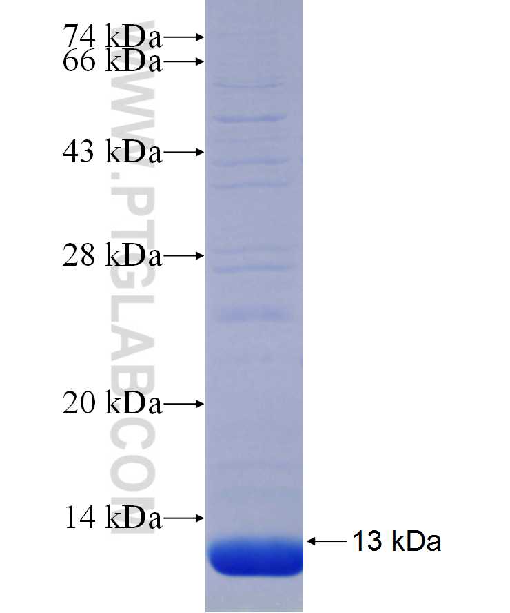 SLC5A11 fusion protein Ag29916 SDS-PAGE