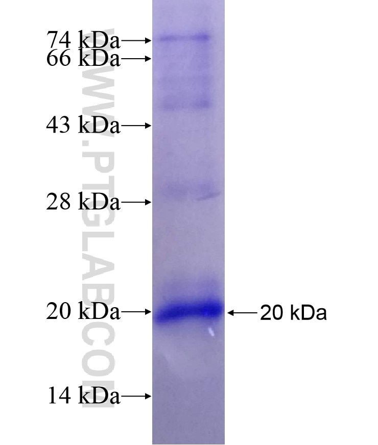 SLC5A11 fusion protein Ag5482 SDS-PAGE