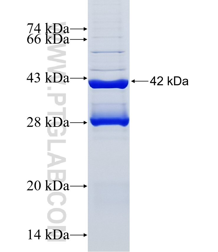 SLC5A12 fusion protein Ag5880 SDS-PAGE