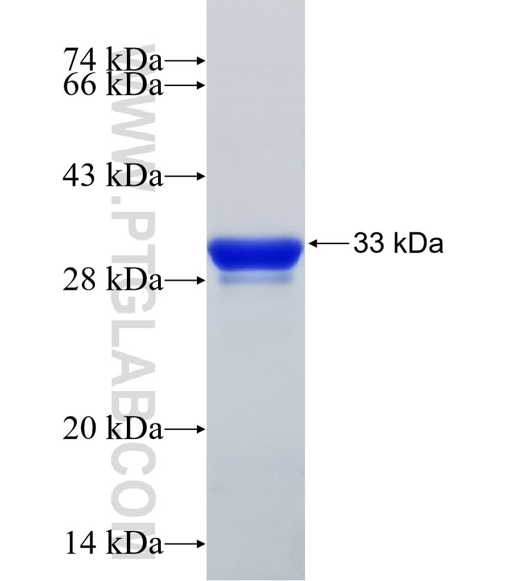 SLC5A2 fusion protein Ag30120 SDS-PAGE