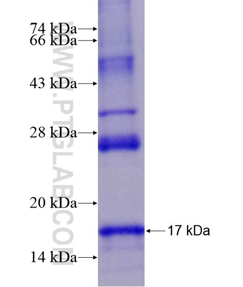 SLC5A2 fusion protein Ag19047 SDS-PAGE