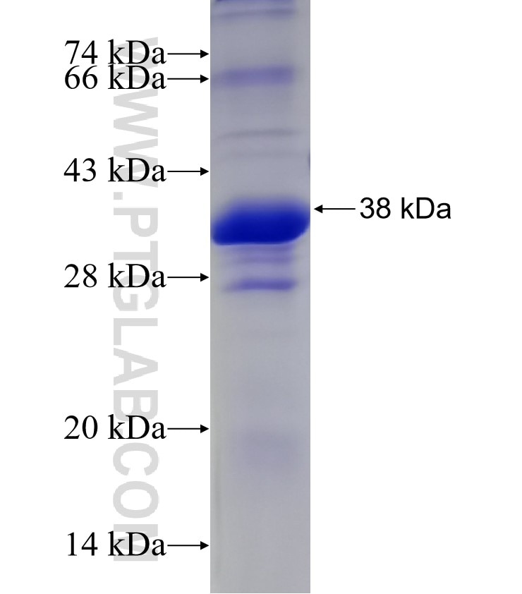 SLC5A2 fusion protein Ag19163 SDS-PAGE