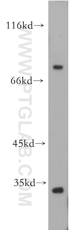 Western Blot (WB) analysis of mouse brain tissue using SLC5A3 Polyclonal antibody (21628-1-AP)