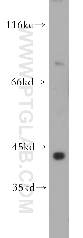 Western Blot (WB) analysis of mouse small intestine tissue using SLC5A3 Polyclonal antibody (21628-1-AP)