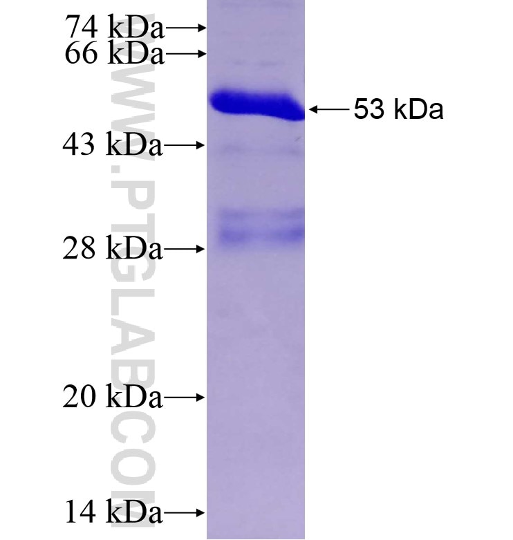 SLC5A3 fusion protein Ag16218 SDS-PAGE