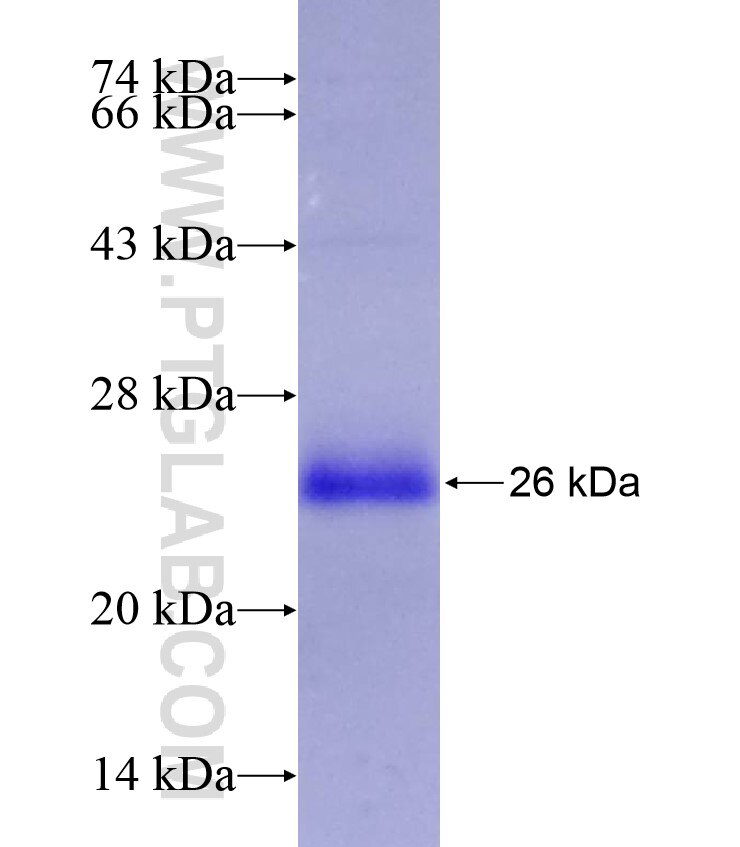 SLC5A3 fusion protein Ag17111 SDS-PAGE