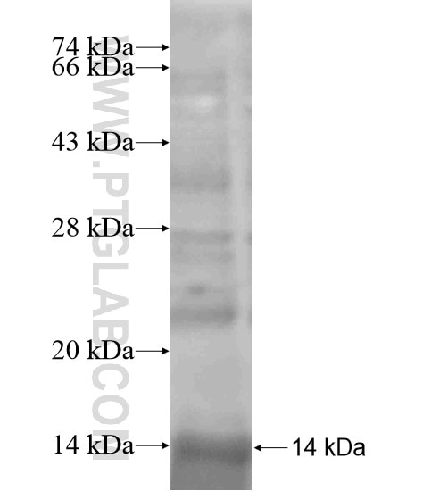 SLC5A4 fusion protein Ag19391 SDS-PAGE